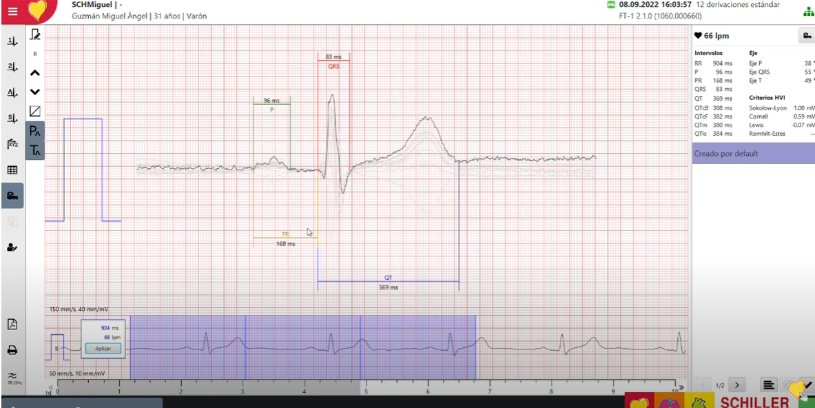 Software SEMA: Innovación en Diagnóstico Cardiovascular de Schille