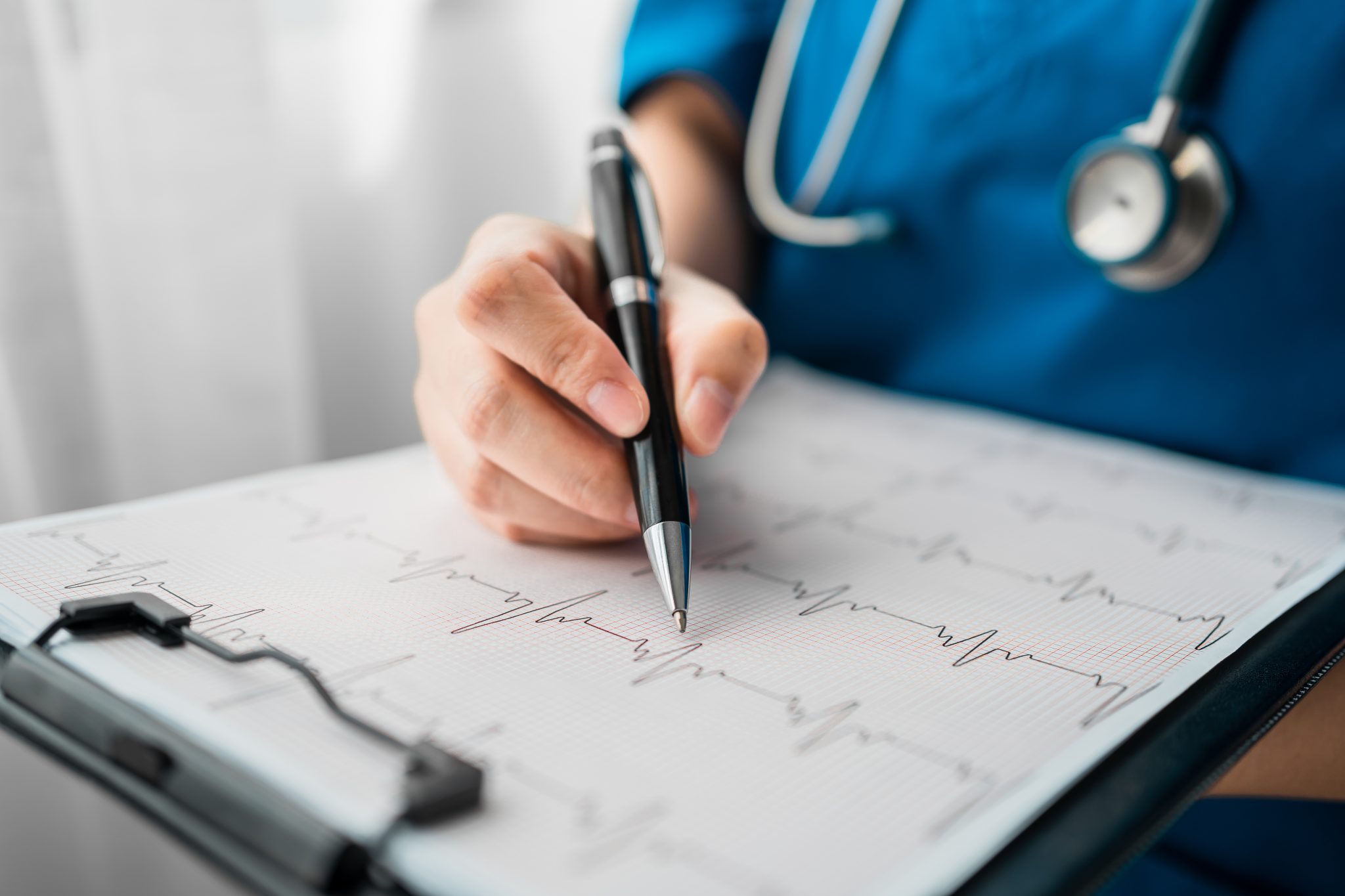 Test de esfuerzo: cómo ayuda a prevenir problemas cardíacos